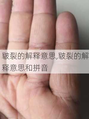 皲裂的解释意思,皲裂的解释意思和拼音